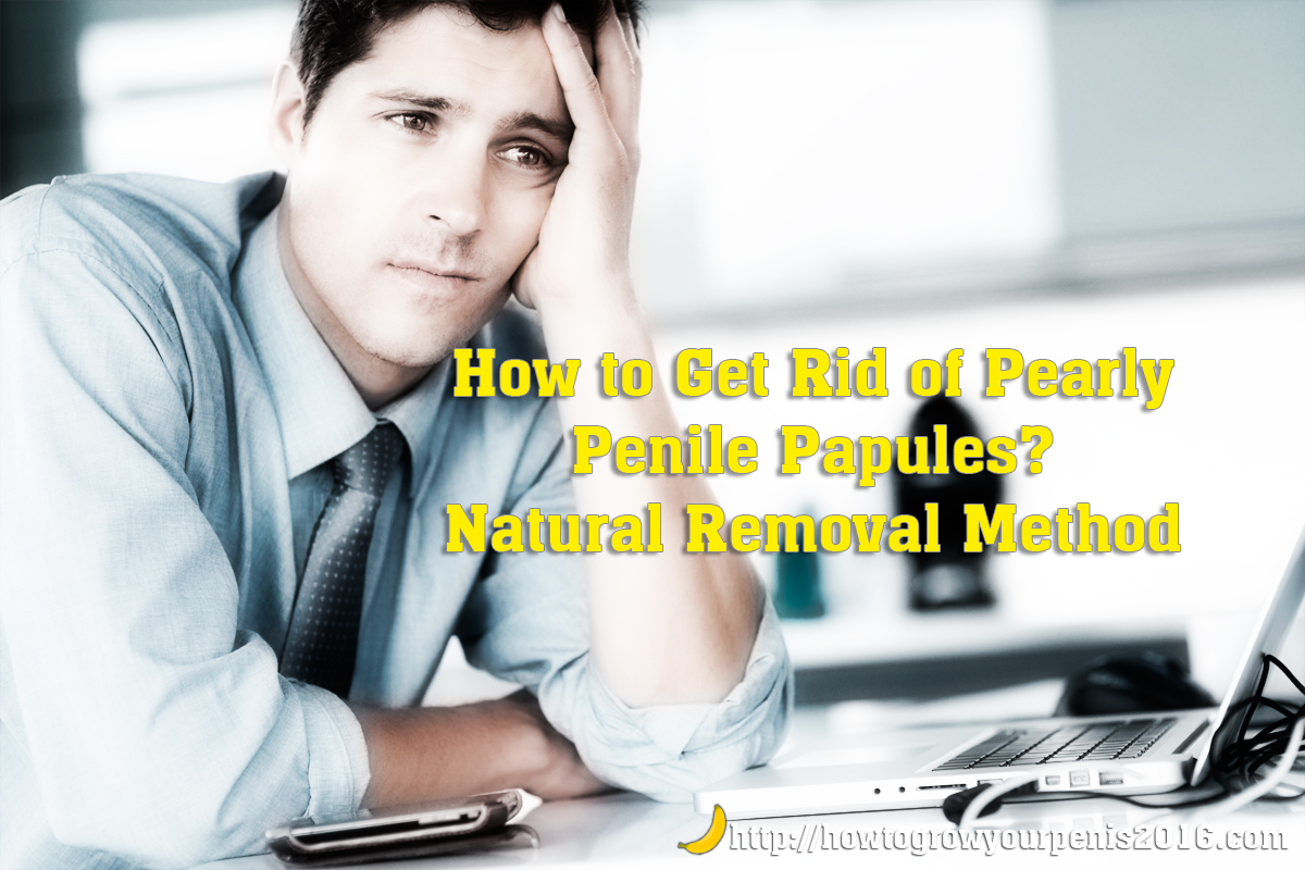 How to Get Rid of Pearly Penile Papules Natural Removal Method