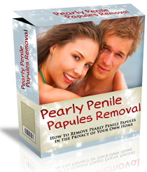 pearly penile papules removal download pdf